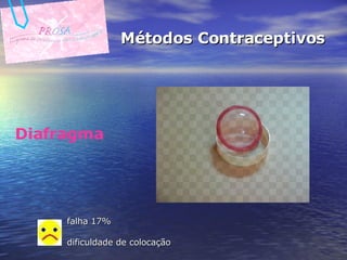 Métodos Contraceptivos Diafragma falha 17% dificuldade de colocação   