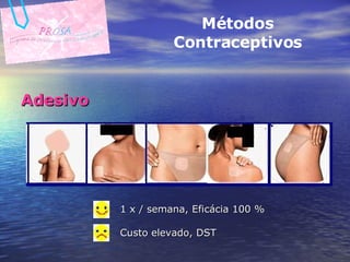 Adesivo Métodos Contraceptivos 1 x / semana, Eficácia 100 % Custo elevado, DST 