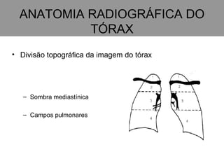 ANATOMIA RADIOGRÁFICA DO TÓRAX Divisão topográfica da imagem do tórax Sombra mediastínica Campos pulmonares 