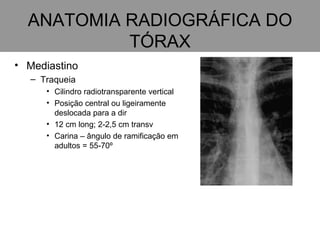 ANATOMIA RADIOGRÁFICA DO TÓRAX Mediastino Traqueia Cilindro radiotransparente vertical  Posição central ou ligeiramente deslocada para a dir   12 cm long; 2-2,5 cm transv Carina – ângulo de ramificação em adultos = 55-70º 