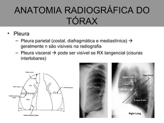 ANATOMIA RADIOGRÁFICA DO TÓRAX Pleura Pleura parietal (costal, diafragmática e mediastínica)    geralmente n são visíveis na radiografia Pleura visceral    pode ser visível se RX tangencial (cisuras interlobares) 
