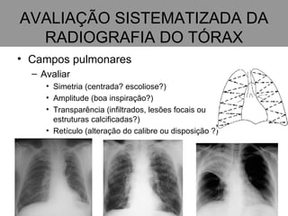 AVALIAÇÃO SISTEMATIZADA DA RADIOGRAFIA DO TÓRAX Campos pulmonares Avaliar Simetria (centrada? escoliose?) Amplitude (boa inspiração?) Transparência (infiltrados, lesões focais ou estruturas calcificadas?) Retículo (alteração do calibre ou disposição ?) 