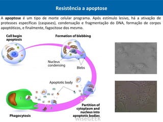 Resistência a apoptose
A apoptose é um tipo de morte celular programa. Após estímulo lesivo, há a ativação de
proteases específicas (caspases), condensação e fragmentação do DNA, formação de corpos
apoptóticos, e finalmente, fagocitose dos mesmo.
 