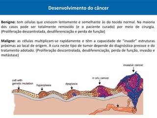 Desenvolvimento do câncer
Benigno: tem células que crescem lentamente e semelhante às do tecido normal. Na maioria
dos casos pode ser totalmente removido (e o paciente curado) por meio de cirurgia.
(Proliferação descontrolada, desdiferenciação e perda de função)
Maligno: as células multiplicam-se rapidamente e têm a capacidade de “invadir” estruturas
próximas ao local de origem. A cura neste tipo de tumor depende do diagnóstico precoce e do
tratamento adotado. (Proliferação descontrolada, desdiferenciação, perda de função, invasão e
metástase)
 