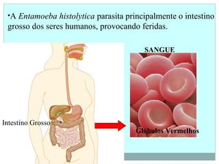 •A Entamoeba histolytica parasita principalmente o intestino
grosso dos seres humanos, provocando feridas.
Intestino Grosso
Glóbulos Vermelhos
SANGUE
 