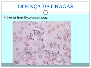 DOENÇA DE CHAGAS
Protozoário: Trypanosoma cruzi.
 