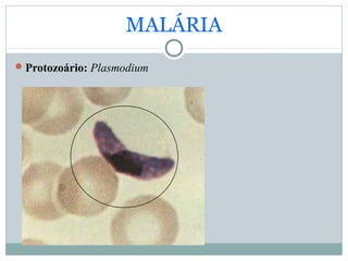 MALÁRIA
Protozoário: Plasmodium
 
