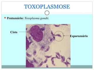 TOXOPLASMOSE
Protozoário: Toxoplasma gondii.
Cisto
Esporozoário
 
