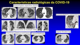 Características radiológicas da COVID-19
 