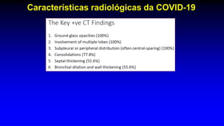 Características radiológicas da COVID-19
 
