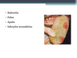 • Sialorréia
• Febre
• Apatia
• Infecções secundárias
 