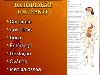 EFEITOS BIOLÓGICOS DA RADIAÇÃO IONIZANTE Cerebrais Aos olhos Boca Estômago Gestação Ovários Medula óssea Vasos sanguíneos 