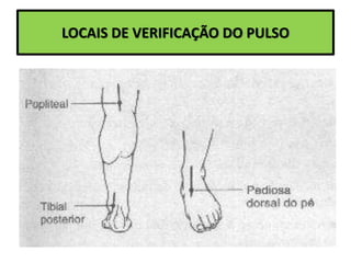 LOCAIS DE VERIFICAÇÃO DO PULSO
 