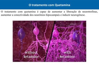 O tratamento com Quetamina
O tratamento com quetamina é capaz de aumentar a liberação de neurotrofinas,
aumentar a conectividade dos neurônios hipocampais e induzir neurogênese.
 