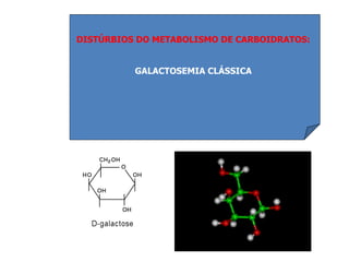 DISTÚRBIOS DO METABOLISMO DE CARBOIDRATOS:
GALACTOSEMIA CLÁSSICA
 