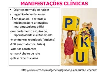 • Crianças normais ao nascer
• Ingestão de fenilalanina:
-  fenilalanina → retarda a
mielinização → alterações
neuromusculares e RM
-comportamento esquizóide,
hiperatividade e irritabilidade
-movimentos repetitivos (autismo)
-EEG anormal (convulsões)
-vômitos constantes
-urina c/ cheiro de rato
-pele e cabelos claros
MANIFESTAÇÕES CLÍNICAS
http://www.ucm.es/info/genetica/grupod/Genenzima/Genenzim
 