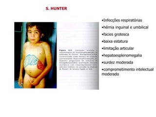 S. HUNTER
•Infecções respiratórias
•hérnia inguinal e umbilical
•facies grotesca
•baixa estatura
•limitação articular
•hepatoesplenomegalia
•surdez moderada
•comprometimento intelectual
moderado
 