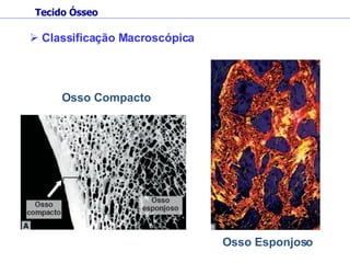 Classificação Macroscópica Osso Compacto Osso Esponjoso Tecido Ósseo 