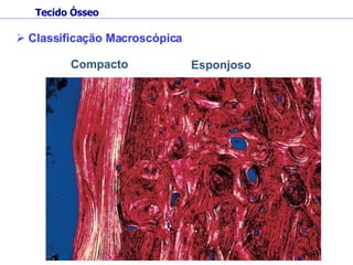 Compacto Classificação Macroscópica Esponjoso Tecido Ósseo 