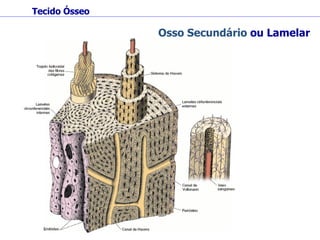 Tecido Ósseo Osso Secundário  ou Lamelar 