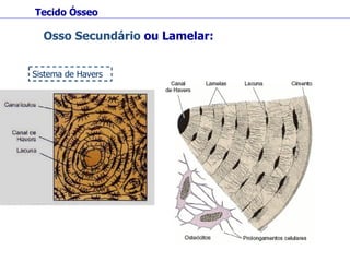 Tecido Ósseo Osso Secundário  ou Lamelar: Sistema de Havers 