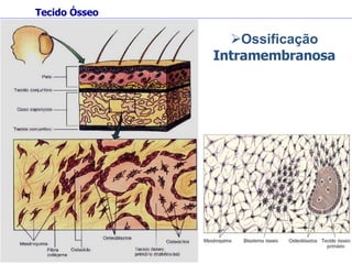 Ossificação  Intramembranosa Tecido Ósseo 