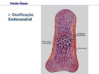 Tecido Ósseo Ossificação  Endocondral   