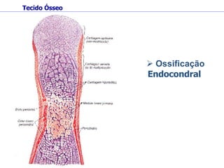 Tecido Ósseo Ossificação  Endocondral   