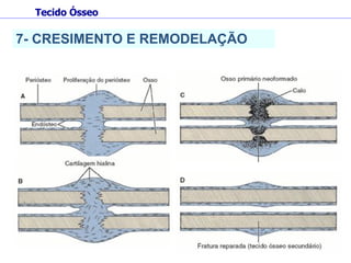 7- CRESIMENTO E REMODELAÇÃO Tecido Ósseo 