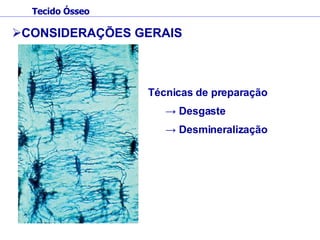 CONSIDERAÇÕES GERAIS Técnicas de preparação ->  Desgaste ->  Desmineralização Tecido Ósseo 