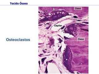 Osteoclastos Tecido Ósseo 