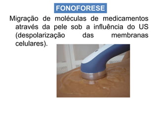 Migração de moléculas de medicamentos
através da pele sob a influência do US
(despolarização das membranas
celulares).
FONOFORESE
 