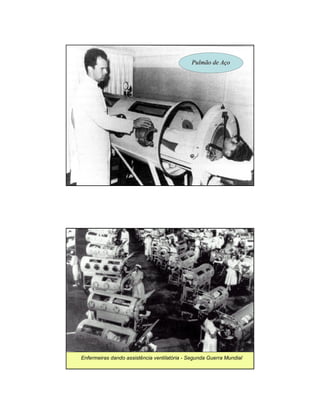 PPuullmmããoo ddee AAççoo 
Enfermeiras dando assistência ventilatória - Segunda Guerra Mundial 
 