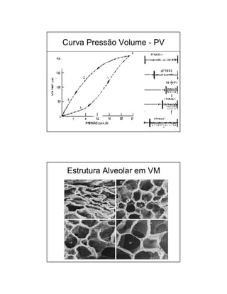 Curva Pressão Volume - PV 
Estrutura Alveolar em VM 
 
