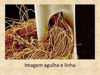Imagem agulha e linha
 
