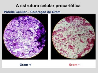 A estrutura celular procariótica
Parede Celular – Coloração de Gram
 
