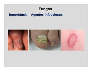 Fungos
Importância – Agentes infecciosos
 