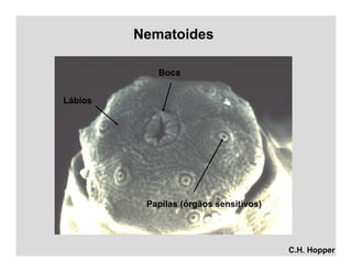 Nematoides
C.H. Hopper
Boca
Papilas (órgãos sensitivos)
Lábios
 