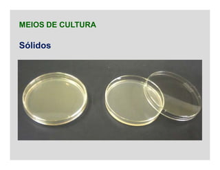MEIOS DE CULTURA
Sólidos
 