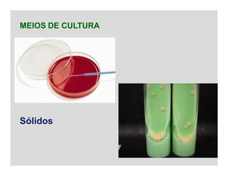 MEIOS DE CULTURA
Sólidos
 