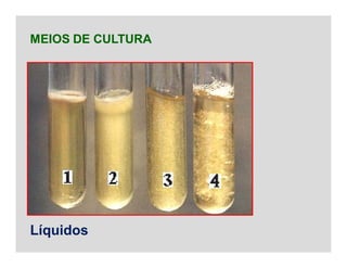 MEIOS DE CULTURA
Líquidos
 