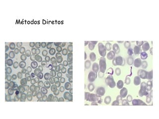 Métodos Diretos
 