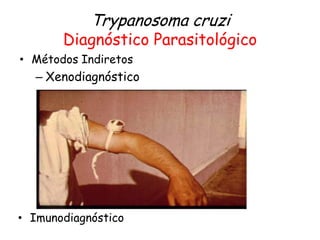 Trypanosoma cruzi
Diagnóstico Parasitológico
• Métodos Indiretos
– Xenodiagnóstico
• Imunodiagnóstico
 