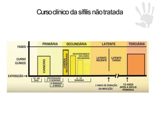 Cursoclínicodasífilis nãotratada
 