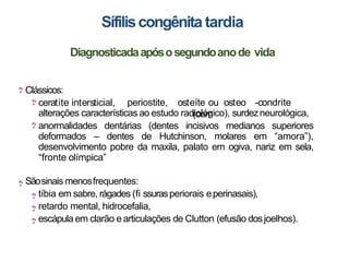 SÍFIL
Clássicos:
ceratite intersticial, periostite, osteíte ou osteo -condrite
(com
alterações características ao estudo radiológico), surdezneurológica,
anormalidades dentárias (dentes incisivos medianos superiores
deformados – dentes de Hutchinson, molares em “amora”),
desenvolvimento pobre da maxila, palato em ogiva, nariz em sela,
“fronte olímpica”
Sãosinais menosfrequentes:
tíbia em sabre, rágades (fi ssurasperiorais eperinasais),
retardo mental, hidrocefalia,
escápula em clarão e articulações de Clutton (efusão dosjoelhos).
Sífiliscongênita tardia
Diagnosticadaapósosegundoanode vida
 