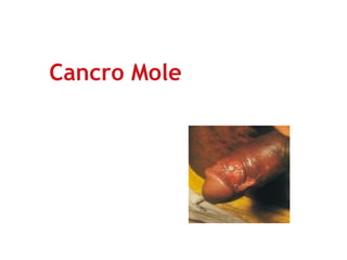 Cancro Mole
 