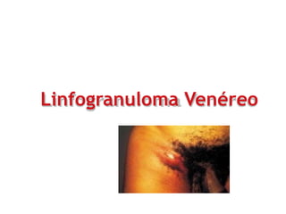 Linfogranuloma Venéreo
 