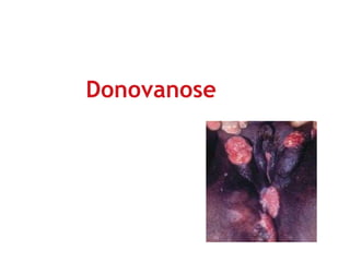 Donovanose
 