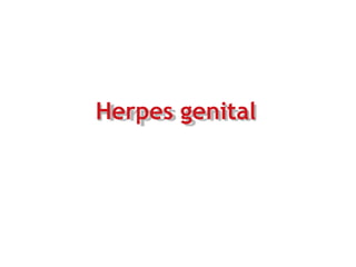 Herpes genital
 