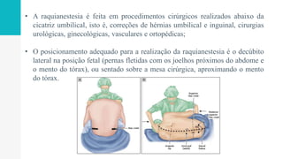 • A raquianestesia é feita em procedimentos cirúrgicos realizados abaixo da
cicatriz umbilical, isto é, correções de hérnias umbilical e inguinal, cirurgias
urológicas, ginecológicas, vasculares e ortopédicas;
• O posicionamento adequado para a realização da raquianestesia é o decúbito
lateral na posição fetal (pernas fletidas com os joelhos próximos do abdome e
o mento do tórax), ou sentado sobre a mesa cirúrgica, aproximando o mento
do tórax.
 